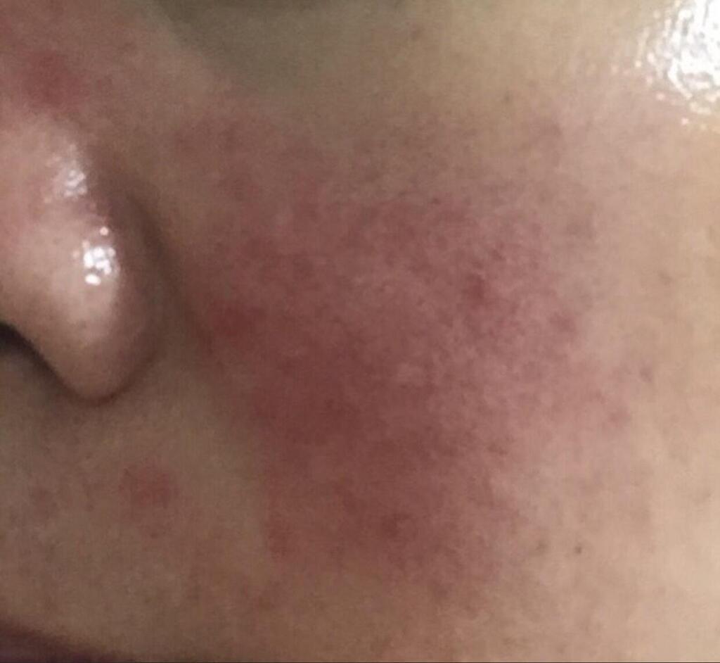 Bild #2 von sunnyeo lee