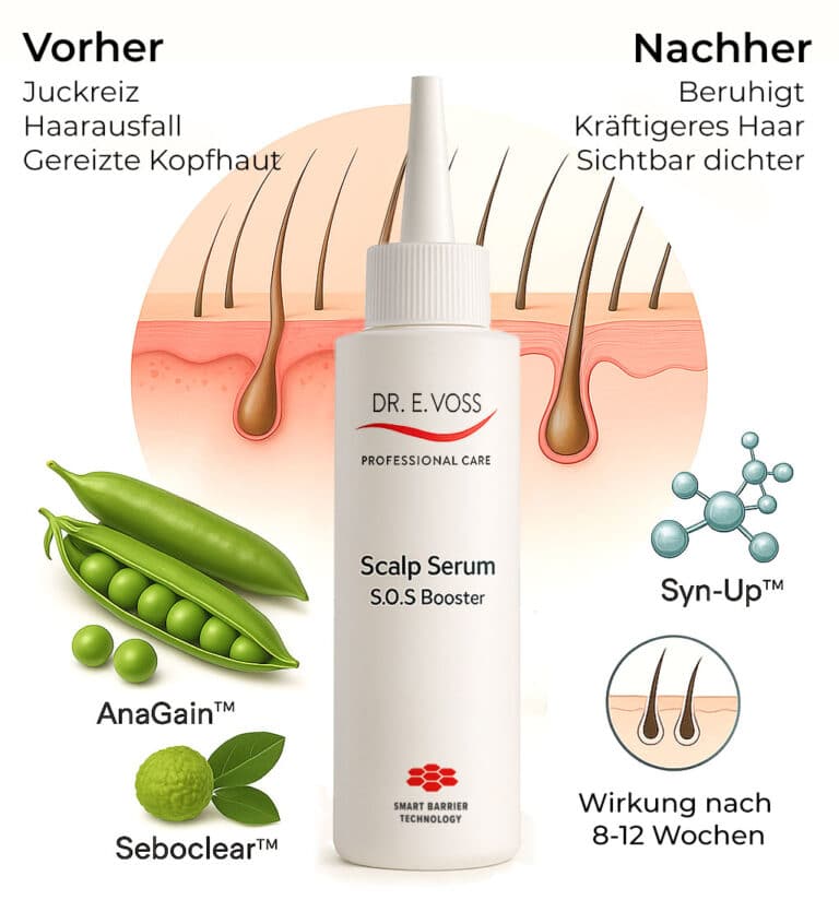 Grafik mit Kopfhautserum im Zentrum, umgeben von Icons der Wirkstoffe AnaGain™, Syn-Up™ und Seboclear™ – links gereizte, haarlose Kopfhaut, rechts beruhigte, dichte Haarstruktur