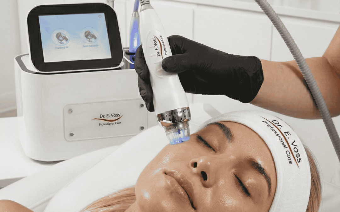 Eine Kundin lässt sich in einem professionellen Kosmetiksalon mit RF-Needling behandeln